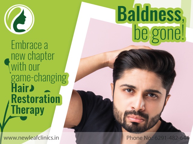 Read more about the article Is Hair Transplant Permanent? Does It Work?