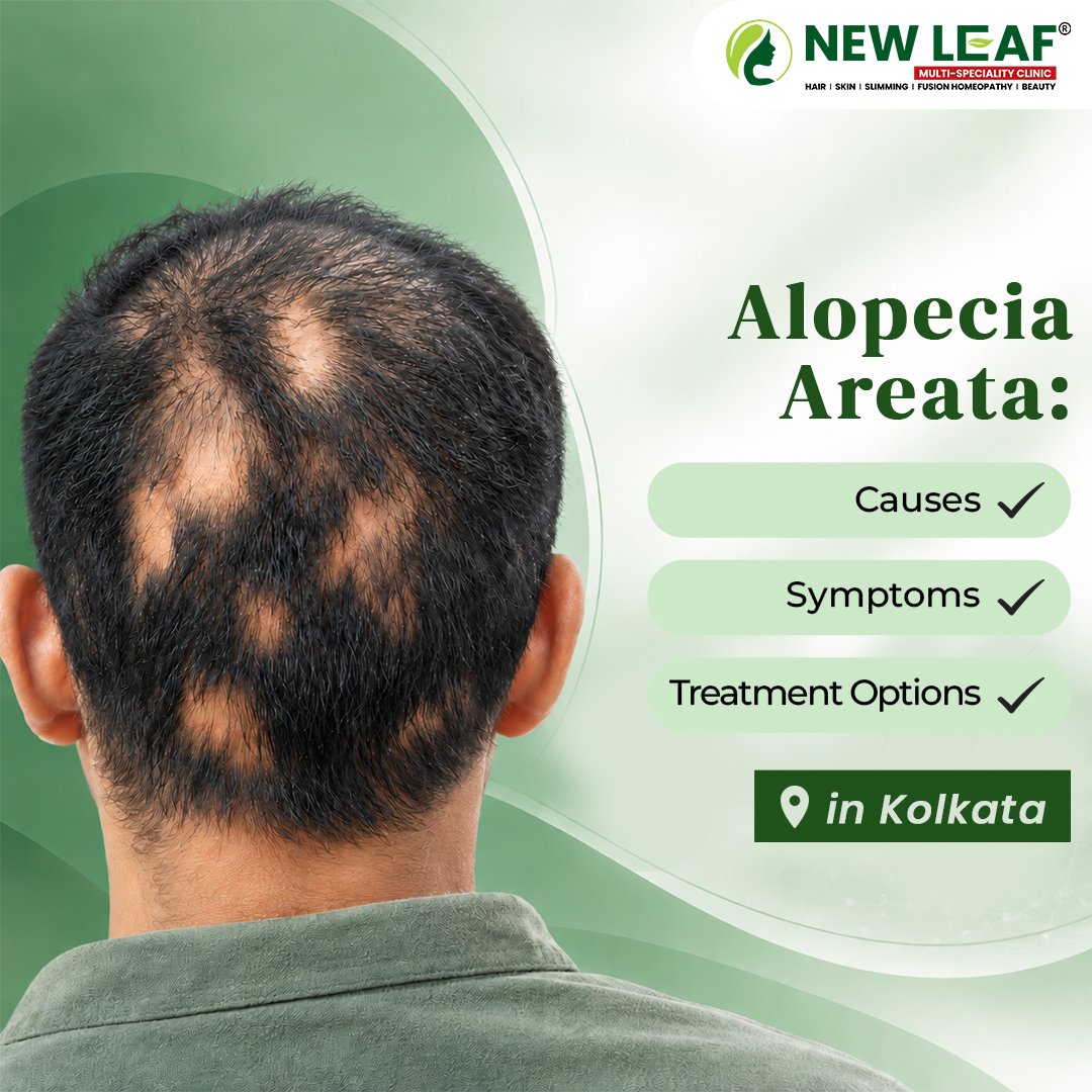You are currently viewing Alopecia Areata: Causes, Symptoms & Treatment Options in Kolkata